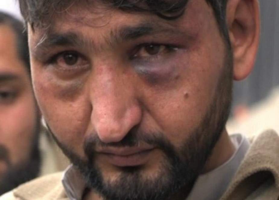 پشاور، مفت سبزی نہ دینے پر پولیس کا دکاندار پر تشدد