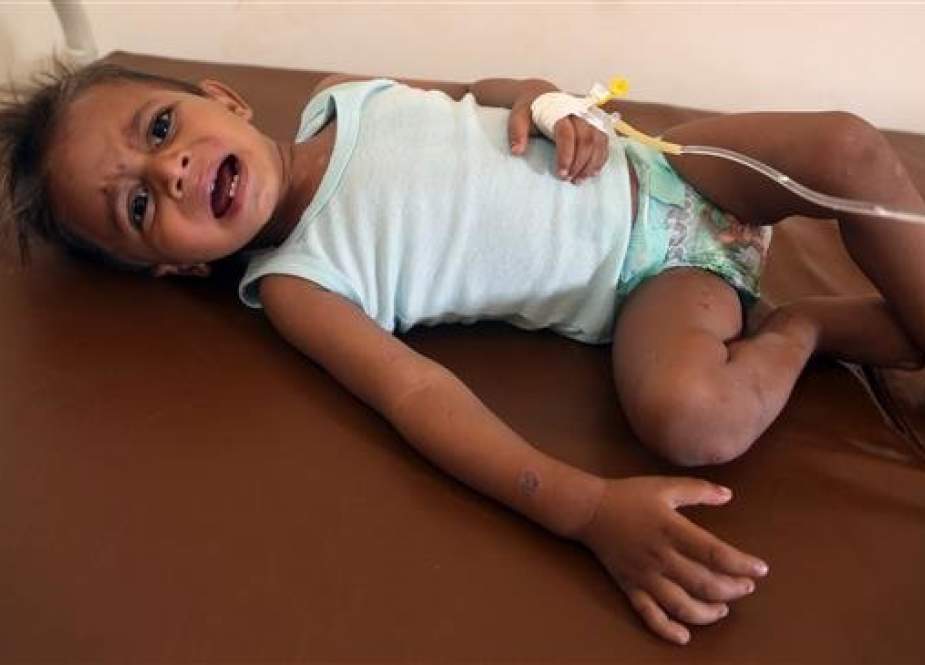 A Yemeni child is treated at a hospital in the coastal city of al-Hudaydah, Yemen, on October 6, 2018. (Photo by AFP)