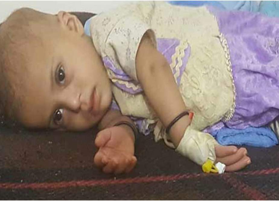 وزیر بهداشت یمن: افزایش مبتلایان به سرطان/استفاده از سلاحهای ممنوعه
