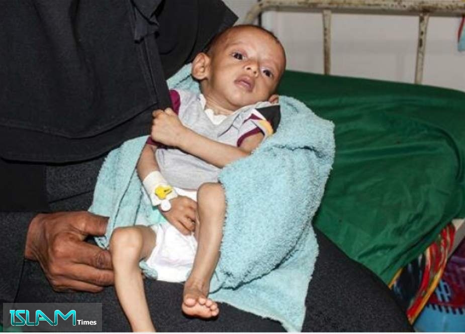 A woman holds a malnourished child receiving treatment at a hospital in Hudaydah, Yemen, June 27, 2019. (Photo by AFP)