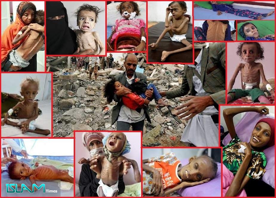 یمن، بدترین انسانی بحران کے دہانے پر!