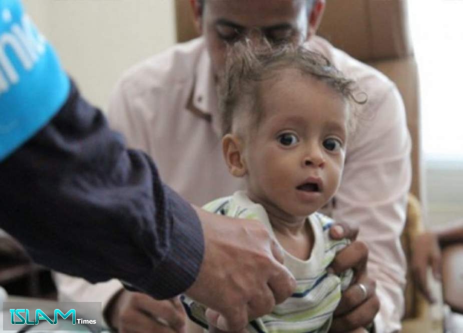 أرقام مرعبة تعلنها اليونسيف حول أطفال اليمن