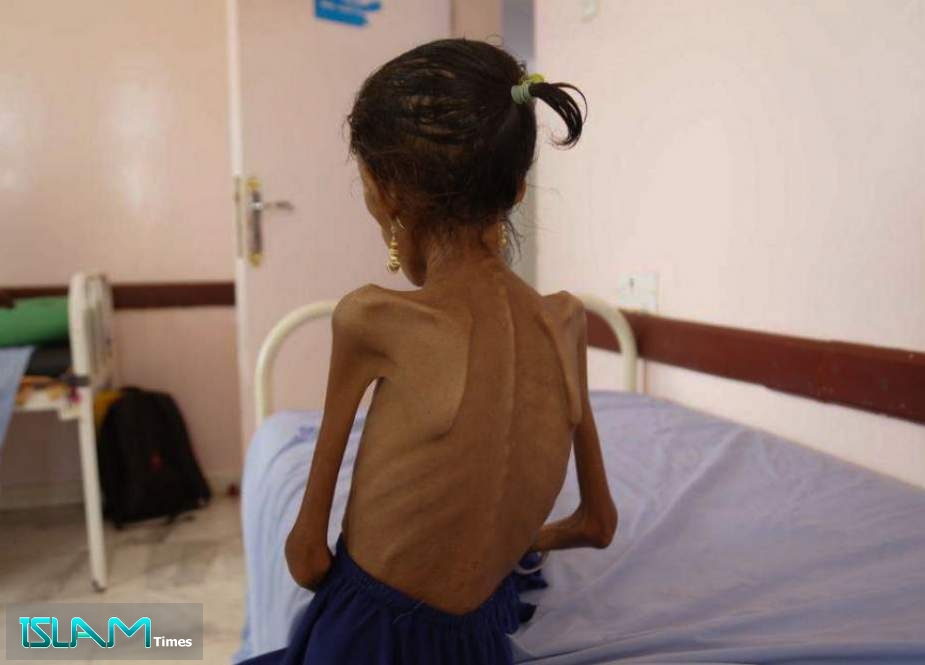 13-year-old Fatima Haddi Ibrahim Koba is pictured in a Hajjah hospital. The Koba family had to flee their farm in Tihama after it was attacked by the Saudi-led coalition,