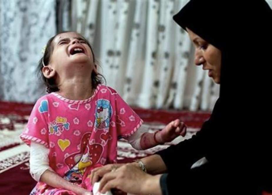Iranian mother dresses the EB wounds of his little daughter, Sareh.jpg