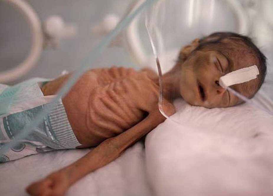 آمار شوکه‌کننده از وضعیت ناگوار نوزادان و کودکان یمنی در پی ۵ سال جنگ