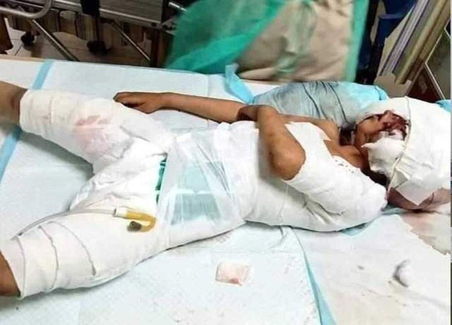 لاڑکانہ میں کتوں کے حملے میں شدید زخمی 6 سالہ حسنین دم توڑ گیا