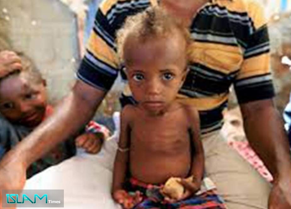 مسؤول أممي يحذّر من خطر مجاعة جديد في اليمن