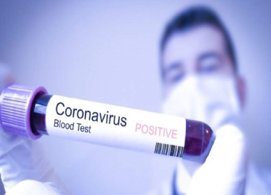 کورونا وائرس کا مشتبہ مریض پمز ہسپتال سے فرار ہو گیا