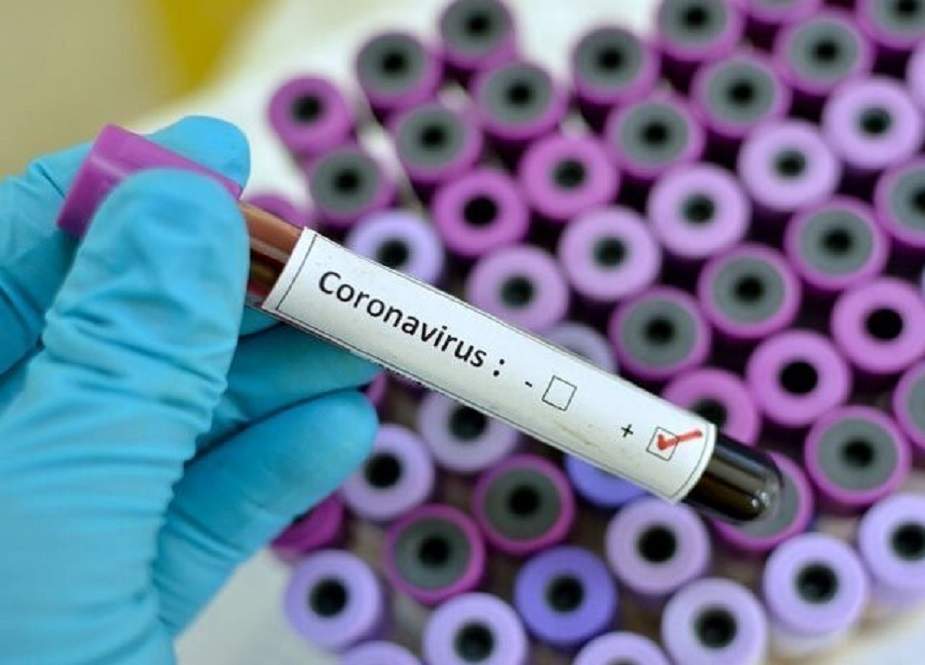 ملک میں کورونا وائرس کا ایک اور کیس سامنے آگیا