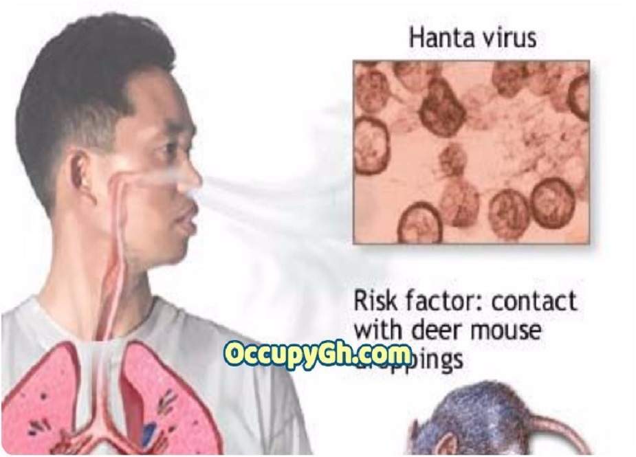 کورونا کے بعد چین میں ’’ہنٹا وائرس‘‘ سر اٹھانے لگا، 1 شخص ہلاک