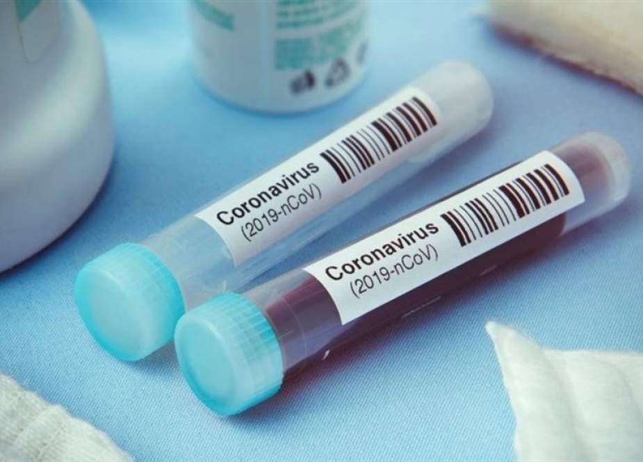 Kit Uji Diagnostik Coronavirus Iran Siap Pasok Pasar Global