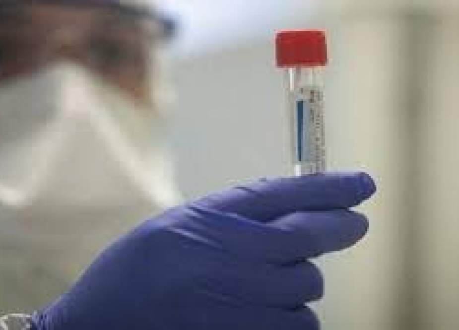 عرب امارات میں صحتیاب افراد کے پلازمہ سے کورونا وائرس کے مریضوں کے علاج کی منظوری