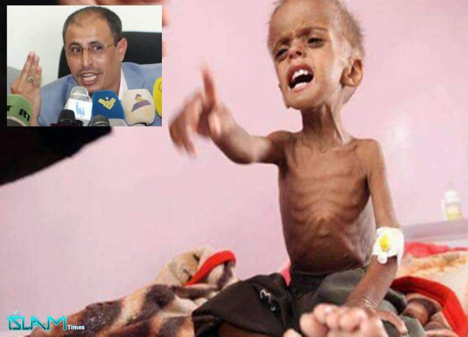 اقوام متحدہ یمنی بچوں کی بھوک اور لاکھوں یمنی بچوں کے قتل عام پر اندھی و بہری ہو چکی ہے، یمن