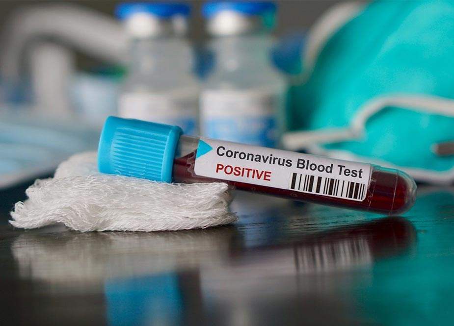 Amerikada ŞOK: Sutka ərzində 71 mindən çox insanda koronavirus aşkar olunub