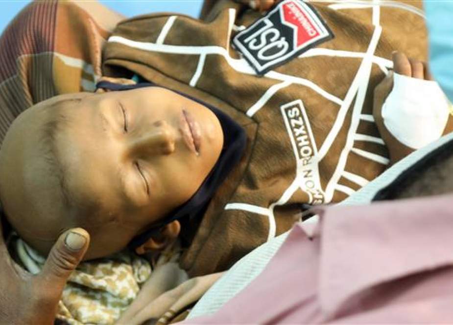 Salah satu penderita kanker di Taiz, Yaman (PressTV).