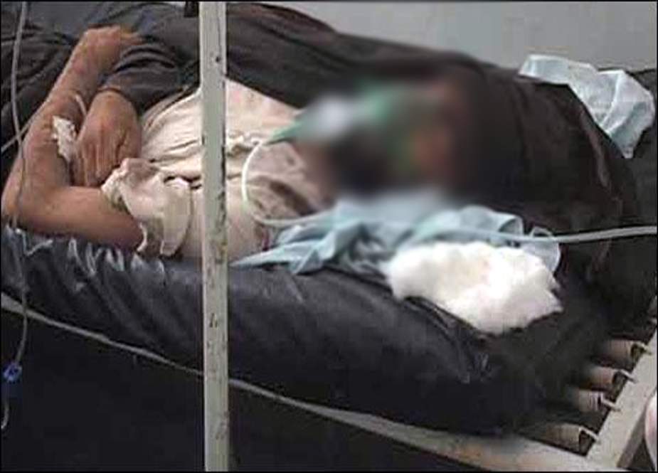 کراچی میں عیدالاضحٰی کے بعد کانگو وائرس کا پہلا کیس سامنے آگیا