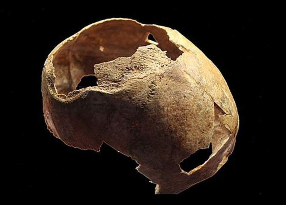 پانچ ہزار سال قبل ناکام آپریشن سے مرنے والے شخص کی کھوپڑی دریافت