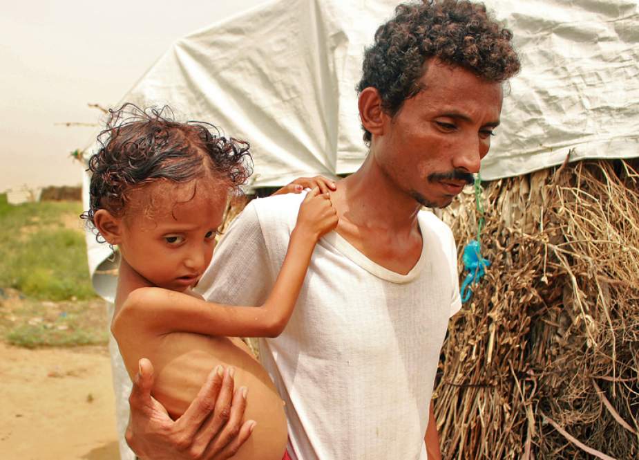 ‘Yaman Kelaparan:’ PBB Mengeluarkan Peringatan Serius