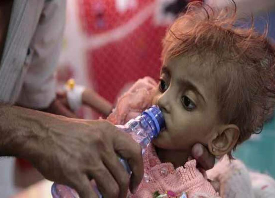 AS, Saudi Arabia Penyebab Tragedi Kemanusiaan Terbesar Bagi Anak-anak Yaman