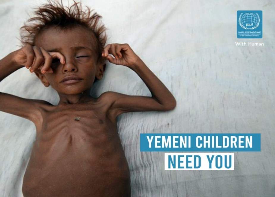 مغربی طاقتوں کا یمنی بچوں کو بھوک، قحط اور موت کا تحفہ