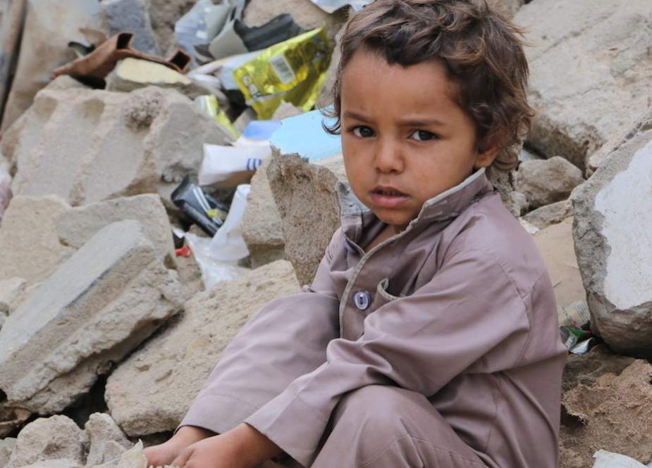 Eyes of a small Yemeni child.jpg