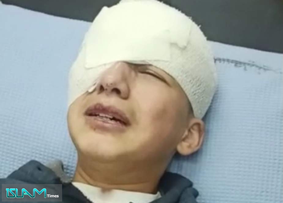 Palestinian Child’s Eye Blinded by Israeli Rubber Bullet in Al-Khalil (Hebron)