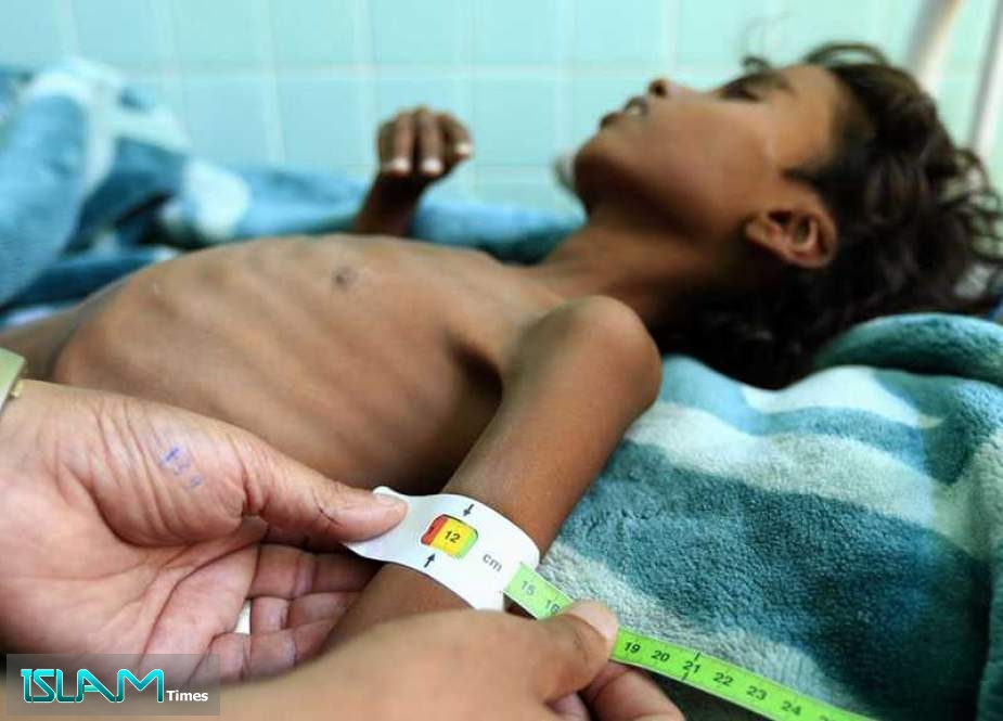 Hundreds of Yemeni Children Have Died Due to UNs’ Failure to Provide Life-saving Basic Devices