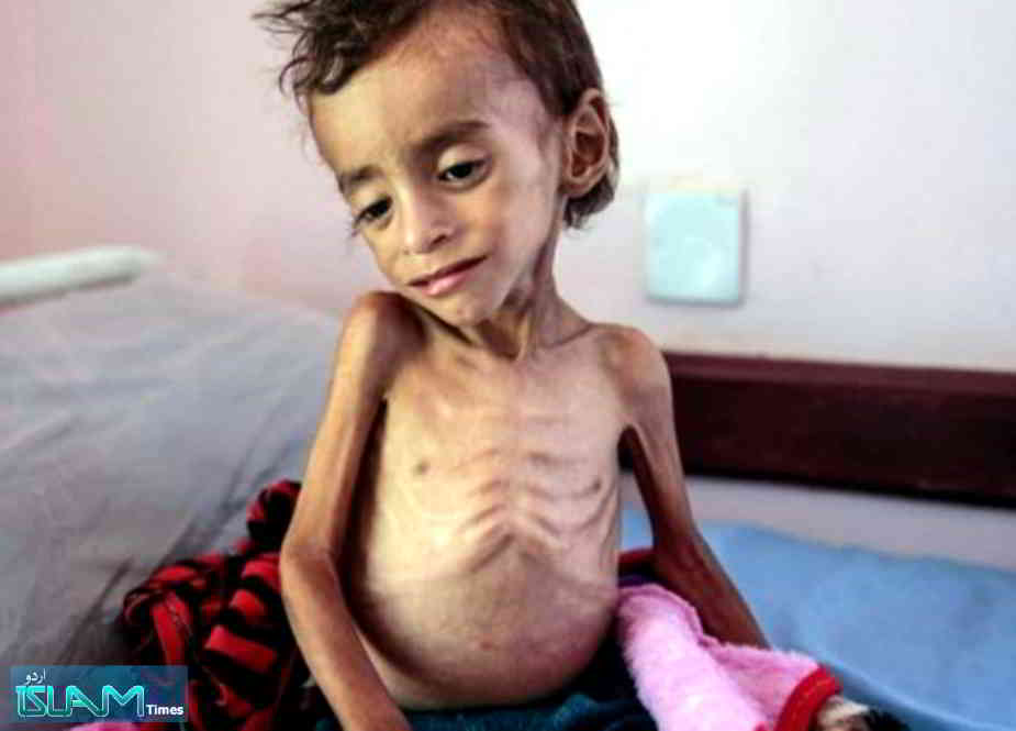 دسیوں لاکھ یمنی بچوں کو اجتماعی موت کا خطرہ لاحق ہے، عامر المرانی