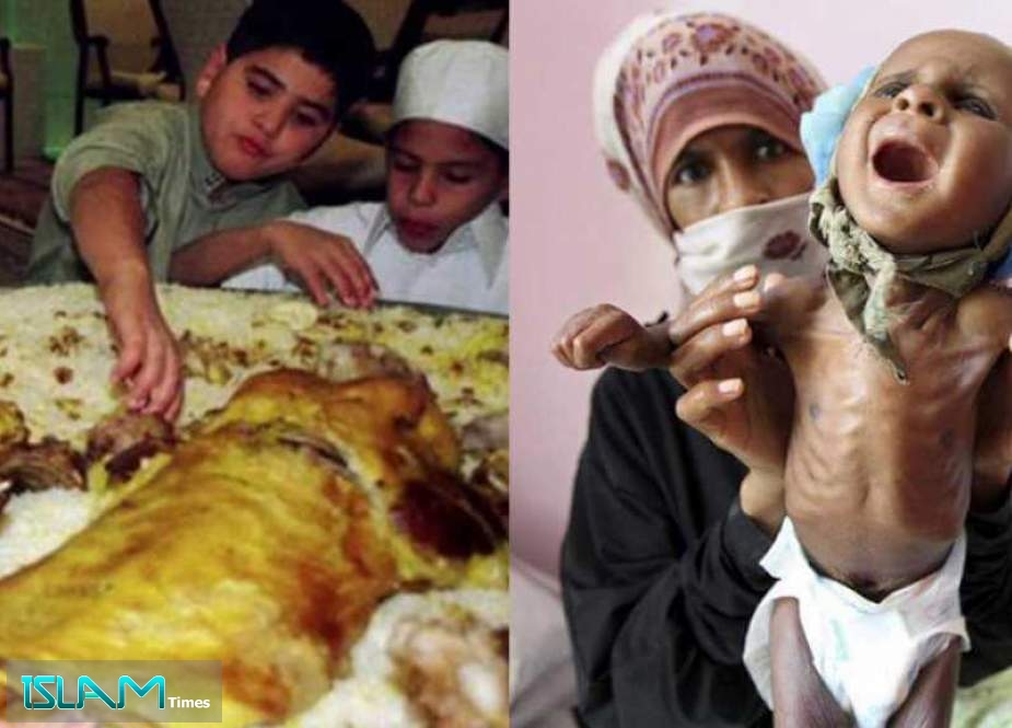 Yemen’s Children Are Dying of Starvation, Saudis Suffer Obesity