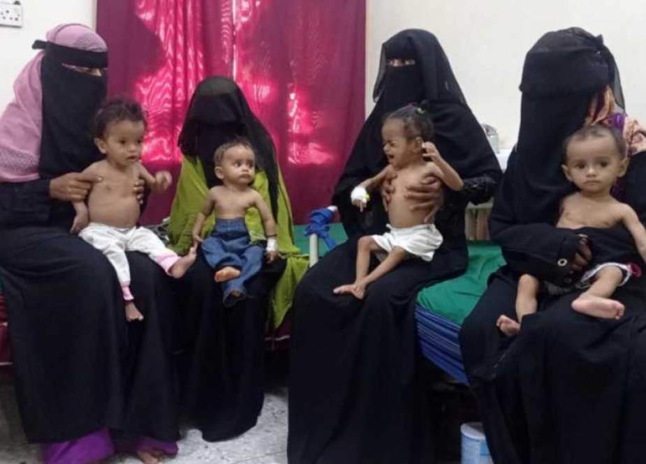 Anak-anak Kelaparan di Yaman sebagai Risiko Berlanjutnya Perang 