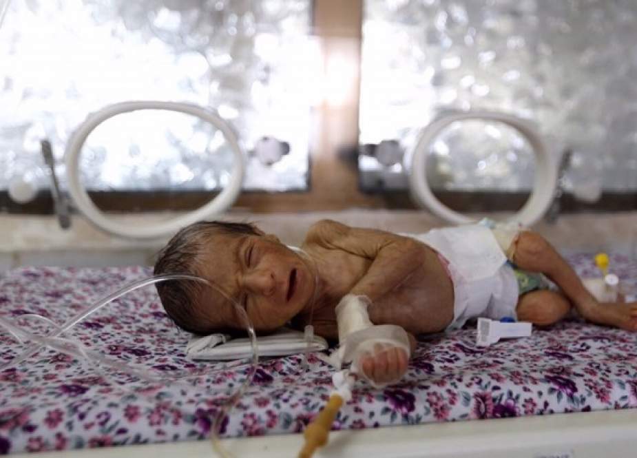 Di Yaman, Lebih dari 80 Bayi Baru Lahir Meninggal Setiap Hari 