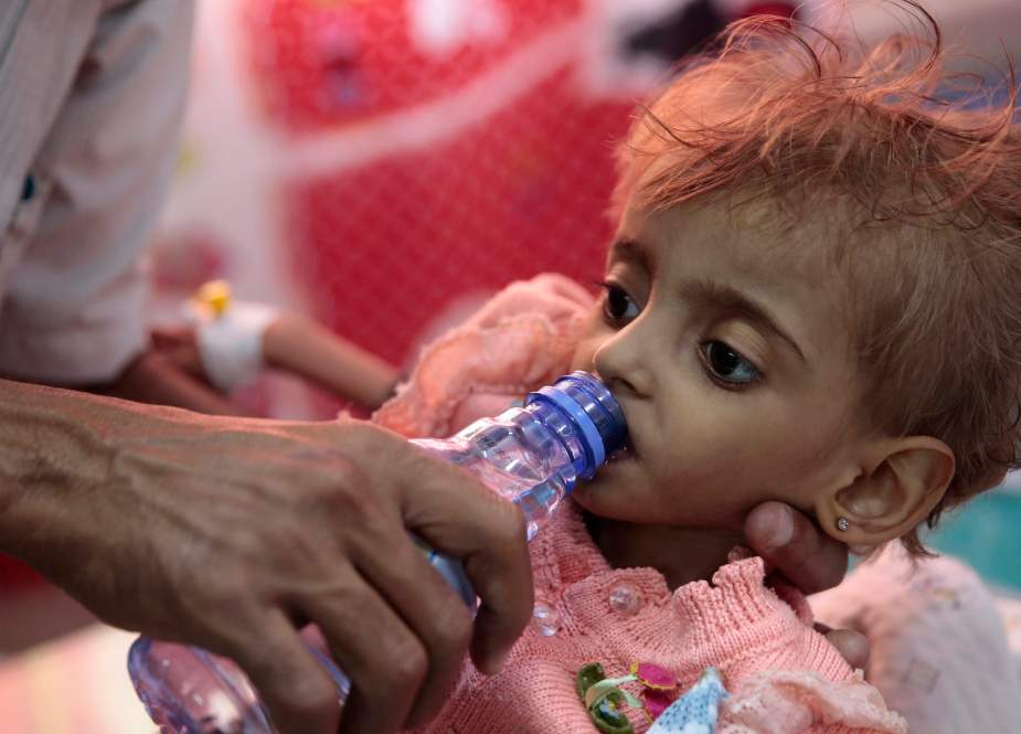  Yaman Mendesak PBB untuk Menyelamatkan Nyawa Lebih dari 5.000 Pasien yang Menderita Gagal Ginjal