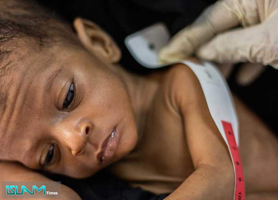 UNICEF: Millions of Children at Risk of Malnutrition in Yemen