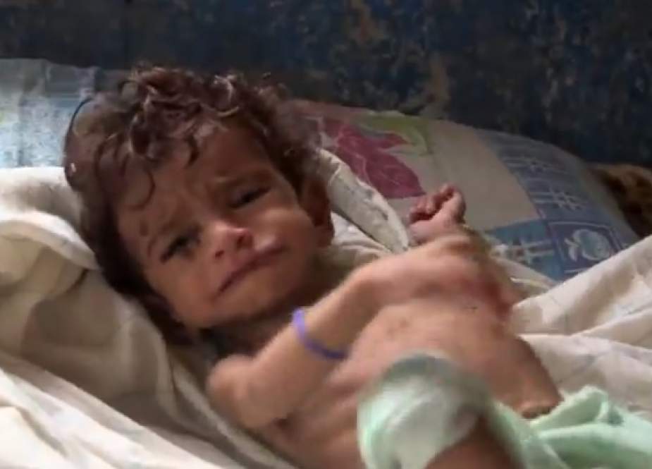 اليونيسف: 6 ملايين طفل يمني علی حافة المجاعة